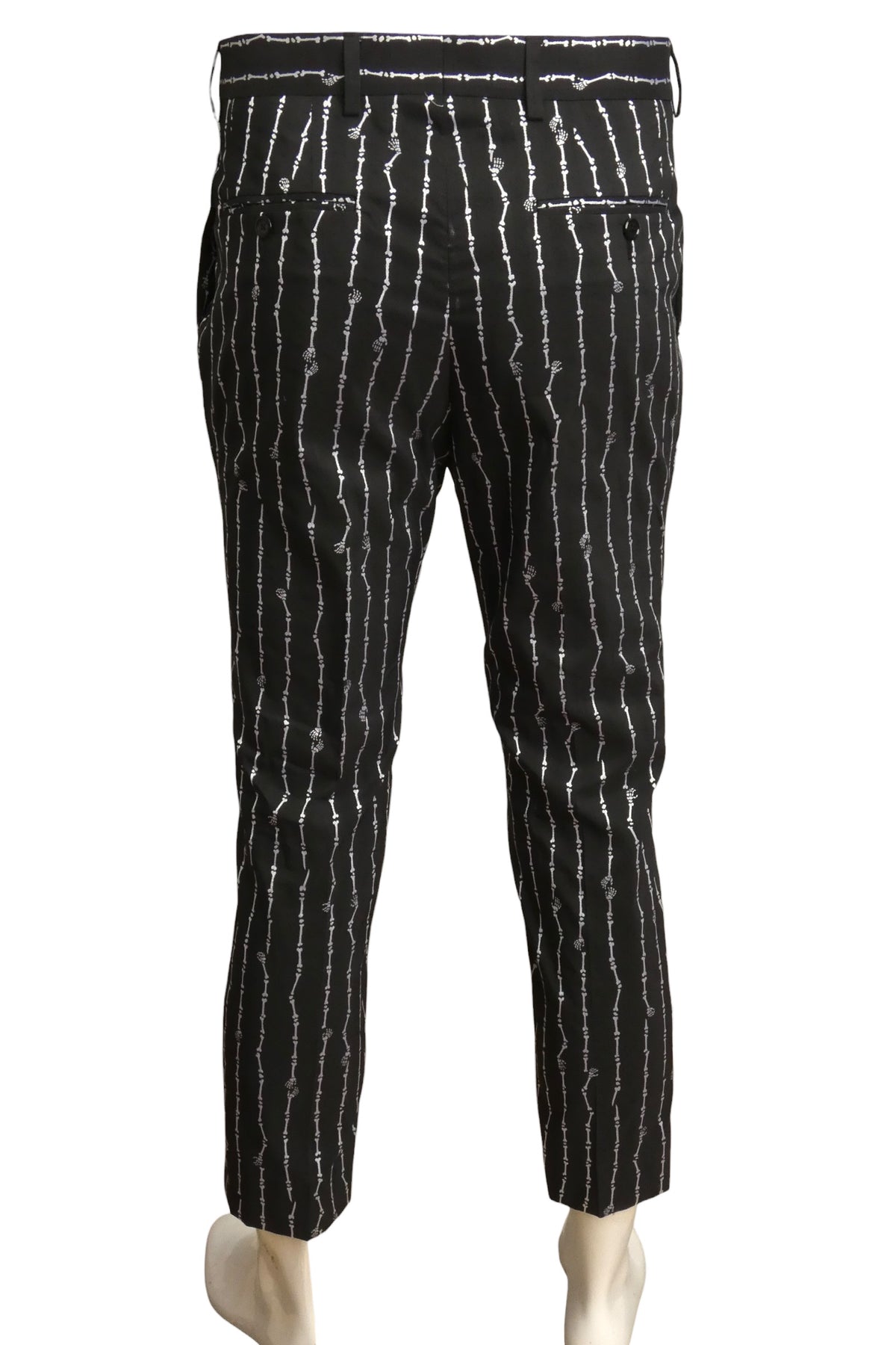 MOSCHINO COUTURE! - 2020 Black Cotton Skeleton. Stripe Cropped Pants, Wait 34"